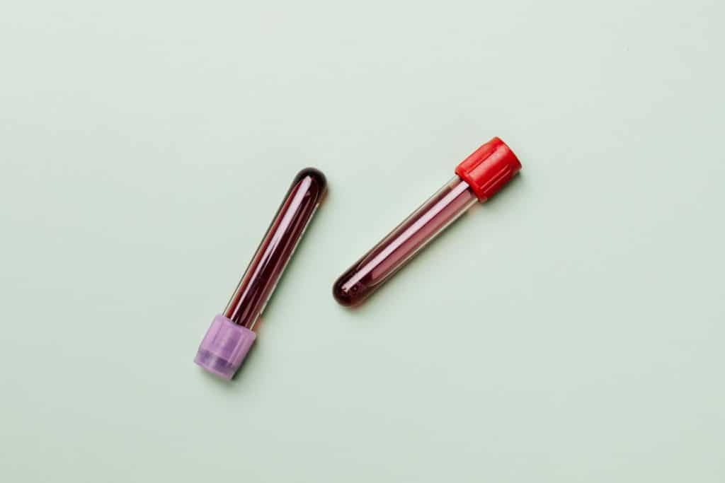 Doliprane 1000 et gamma GT