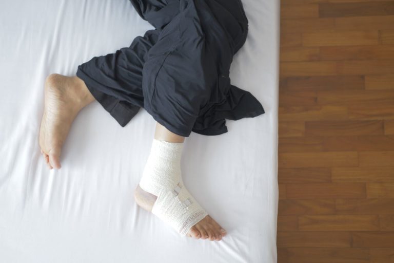 Combien de temps pour marcher apres fracture malleole ?