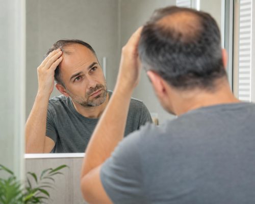 Comprendre la perte de cheveux : un enjeu esthétique et psychologique